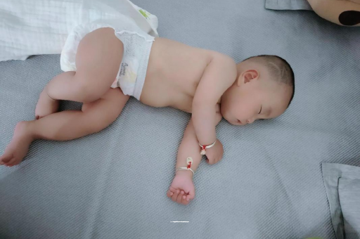 黔西南宝宝头上长痱子